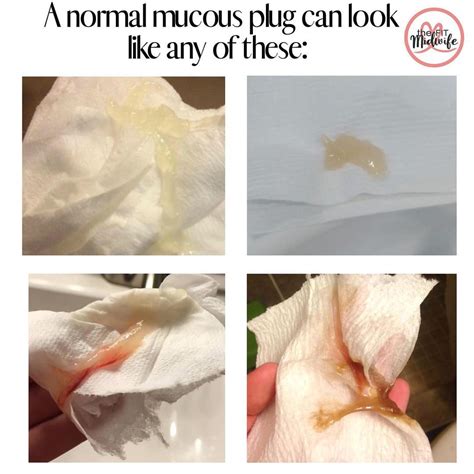 What does the mucus plug look like compared to other discharge ...